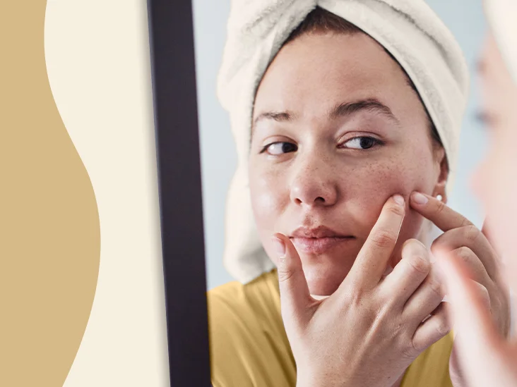 Acne treatment services offered by Dr. Lauber in Newport Beach, CA